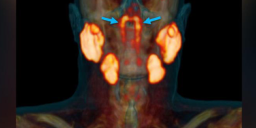 মানবদেহে নতুন অঙ্গের আবিষ্কার