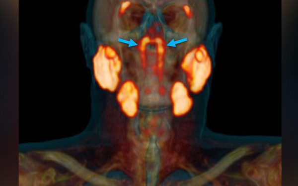 মানবদেহে নতুন অঙ্গের আবিষ্কার