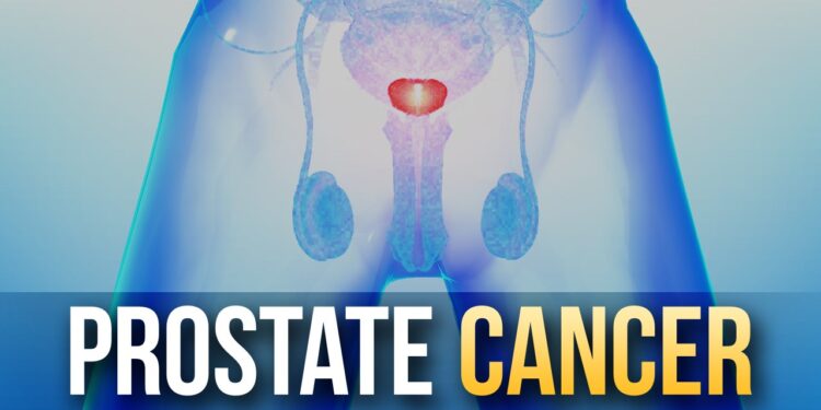 প্রোস্টেট ক্যানসার: যা জানা প্রয়োজন