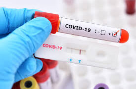 র‌্যাপিড অ্যান্টিজেন টেস্ট কিটের পর্যাপ্ত মজুদ রয়েছে