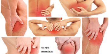 বাত রোগ কেন হয় এবং এর প্রতিকার