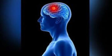 মস্তিষ্কে টিউমার বা ব্রেন টিউমার