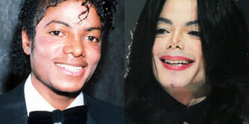 প্লাস্টিক সার্জারি কী ও কিভাবে হয় ?