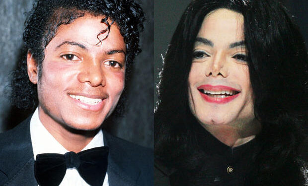 প্লাস্টিক সার্জারি কী ও কিভাবে হয় ?