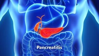 অগ্ন্যাশয়ের নানা অসুখ বিসুখ