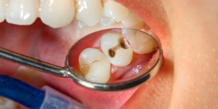 খারাপ দাঁত রোগ সৃষ্টি করে হার্ট বা কিডনীতে !