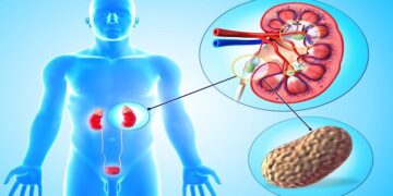 কিডনী রোগের লক্ষণ