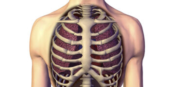 বুকের খাঁচার হাঁড়েও হয় নানা অসুখ