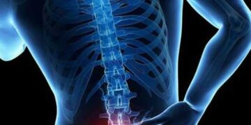 কোমরে ব্যথা- কখন যাবেন ডাক্তারের কাছে ?