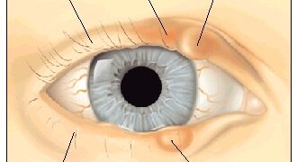 চোখের পাতার যত রোগ