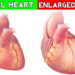 হার্ট বড় হওয়া মোটেই ভালো নয়