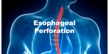 পাকস্থলী ও খাদ্যনালী ফুটো হয়ে যাওয়া