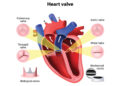 হার্ট ভালভের অসুখবিসুখ