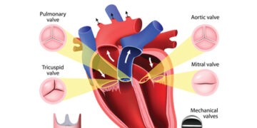 হার্ট ভালভের অসুখবিসুখ