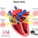 হার্ট ভালভের অসুখবিসুখ
