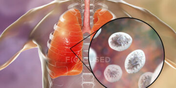 ৬ টি লক্ষণে বোঝা যাবে আপনার ফুসফুসের সমস্যা