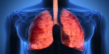 দেশে যক্ষ্মা রোগীদের মধ্যে ১২ জনের এইডস