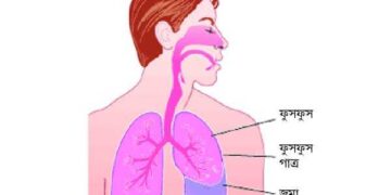 ফুসফুসে পানি জমা রোগের নাম প্লুরাল ইফিউশন