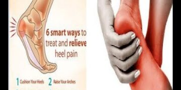 পায়ের গোড়ালি ব্যথার কারণ ও প্রতিকার