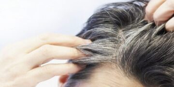 অকালে চুল পাকার কারণ