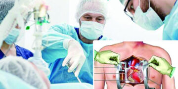 ওপেন হার্ট সার্জারি কি ?