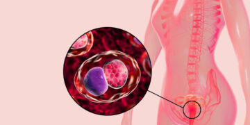 জটিল রোগ ‘ক্ল্যামিডিয়া’