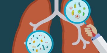 সিস্টিক ফাইব্রোসিস,আক্রমণ করে শ্বসন ও পরিপাকতন্ত্রকে