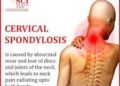 সার্ভিকাল স্পন্ডিলোসিসের সমাধান দিতে পারে এই যোগাসনগুলি!