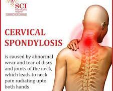 সার্ভিকাল স্পন্ডিলোসিসের সমাধান দিতে পারে এই যোগাসনগুলি!