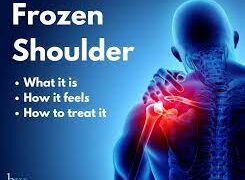 ‘কাঁধে ব্যথা ও ফ্রোজেন শোল্ডার’ সমস্যা ও সমাধান