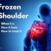 ‘কাঁধে ব্যথা ও ফ্রোজেন শোল্ডার’ সমস্যা ও সমাধান