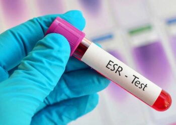 রক্তে ইএসআর (ESR) রেট কমবেশি কেন হয়?