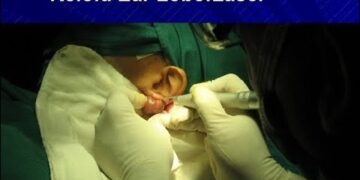 নাক কান গলায় লেজার সার্জারি