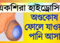 হাইড্রোসিল: কেন পুরুষের অন্ডকোষ ফুলে বড় হয়ে যায়?