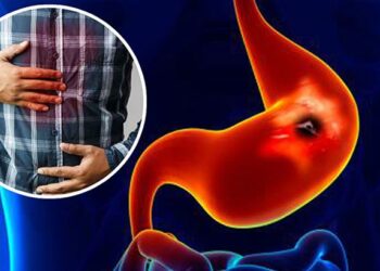 রোজা থেকে গ্যাস্ট্রিকের সমস্যা, কী করবেন