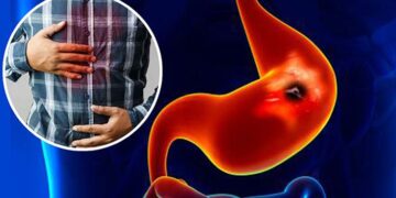 রোজা থেকে গ্যাস্ট্রিকের সমস্যা, কী করবেন