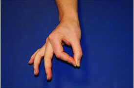 আঙুল অবশ লাগছে কেন?