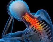 ঘাড়ের বাত :সার্ভাইক্যাল স্পনডাইলোসিস