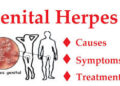 জেনিটাল হারপিস: ছোঁয়াচে গোপন রোগ