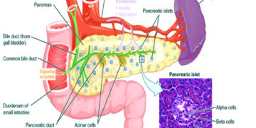 প্যানক্রিয়াস পাথর ও ডায়াবেটিস