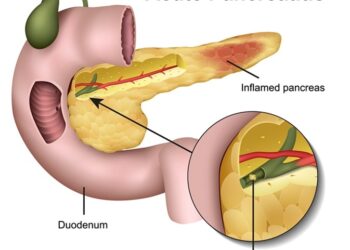 অগ্ন্যাশয়ের ইনফেকশন, প্যানক্রিয়াটাইটিস