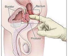 প্রস্টেট গ্রন্থি বড় হলে