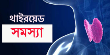থাইরয়েডের সমস্যার চিকিৎসা ও ঔষধ