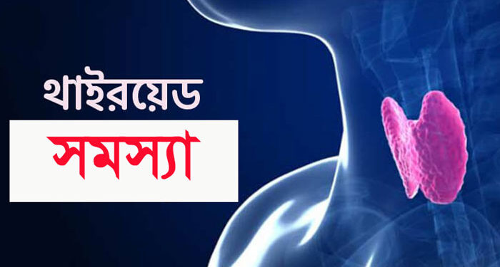 থাইরয়েডের সমস্যার চিকিৎসা ও ঔষধ