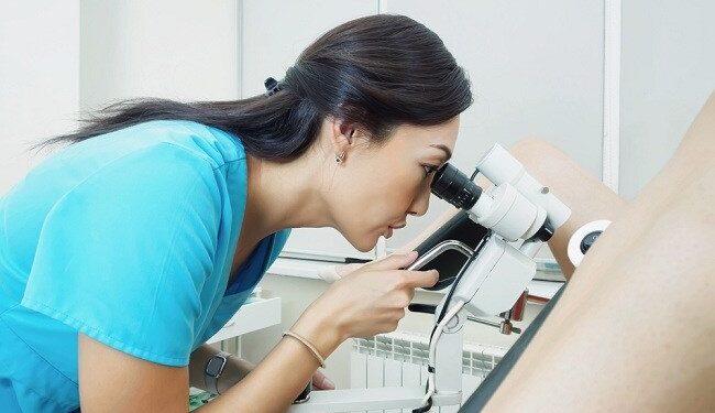 কোলপোস্কোপি কি এবং কেন ?