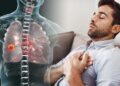 ফুসফুসের রোগে আক্রান্ত কি-না বুঝবেন যেসব লক্ষণে