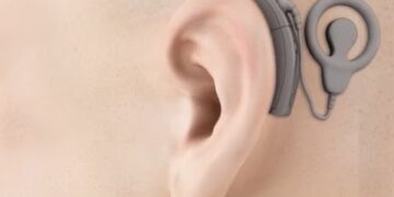 ককলিয়ার ইমপ্লান্ট সার্জারি