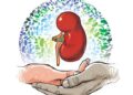 কিডনি প্রতিস্থাপন ( kidney transplant) কখন, কীভাবে?