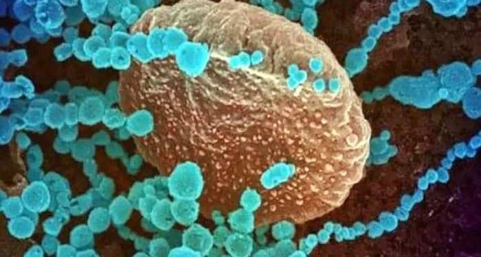 Delta Covid variant becoming globally dominant, WHO official says