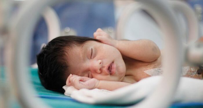 ত্রুটি নিয়ে জন্মানো শিশুদের বেঁচে থাকা নির্ভর করে জন্মস্থানের ওপর: গবেষণা